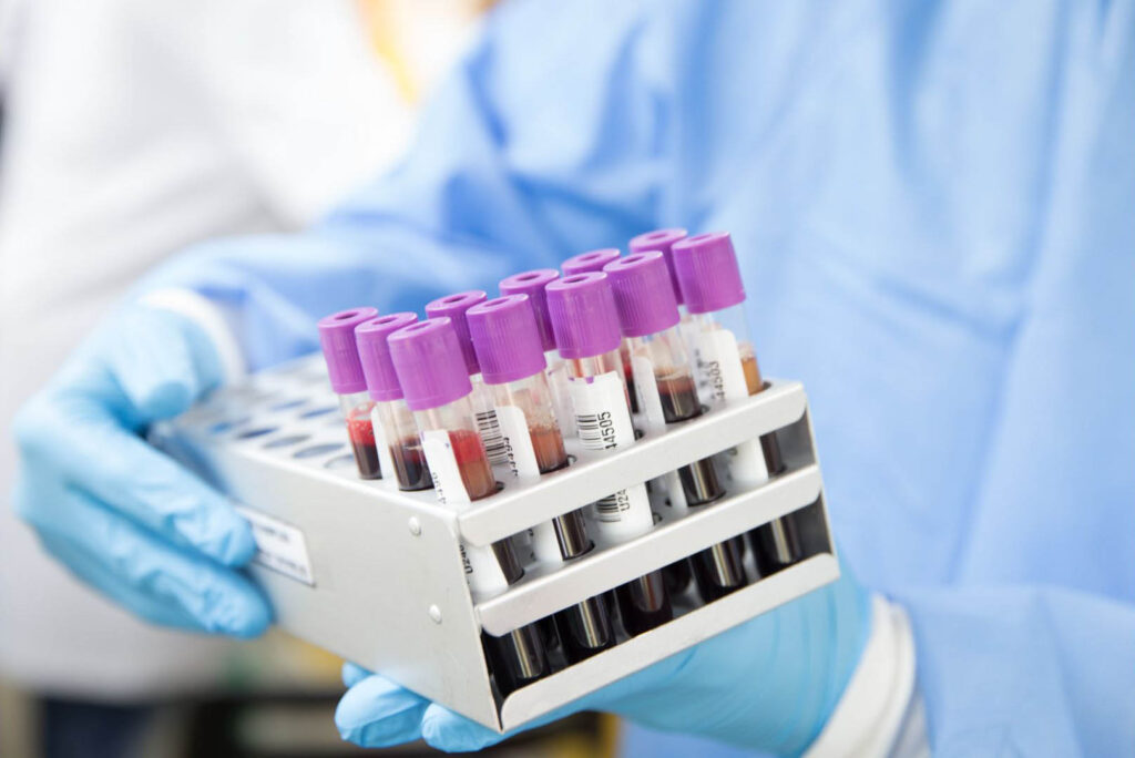 https://www.medicoanalytica.eu/kuidas-moista-laboritesti-tulemusi/